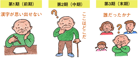 記憶障害の流れ
